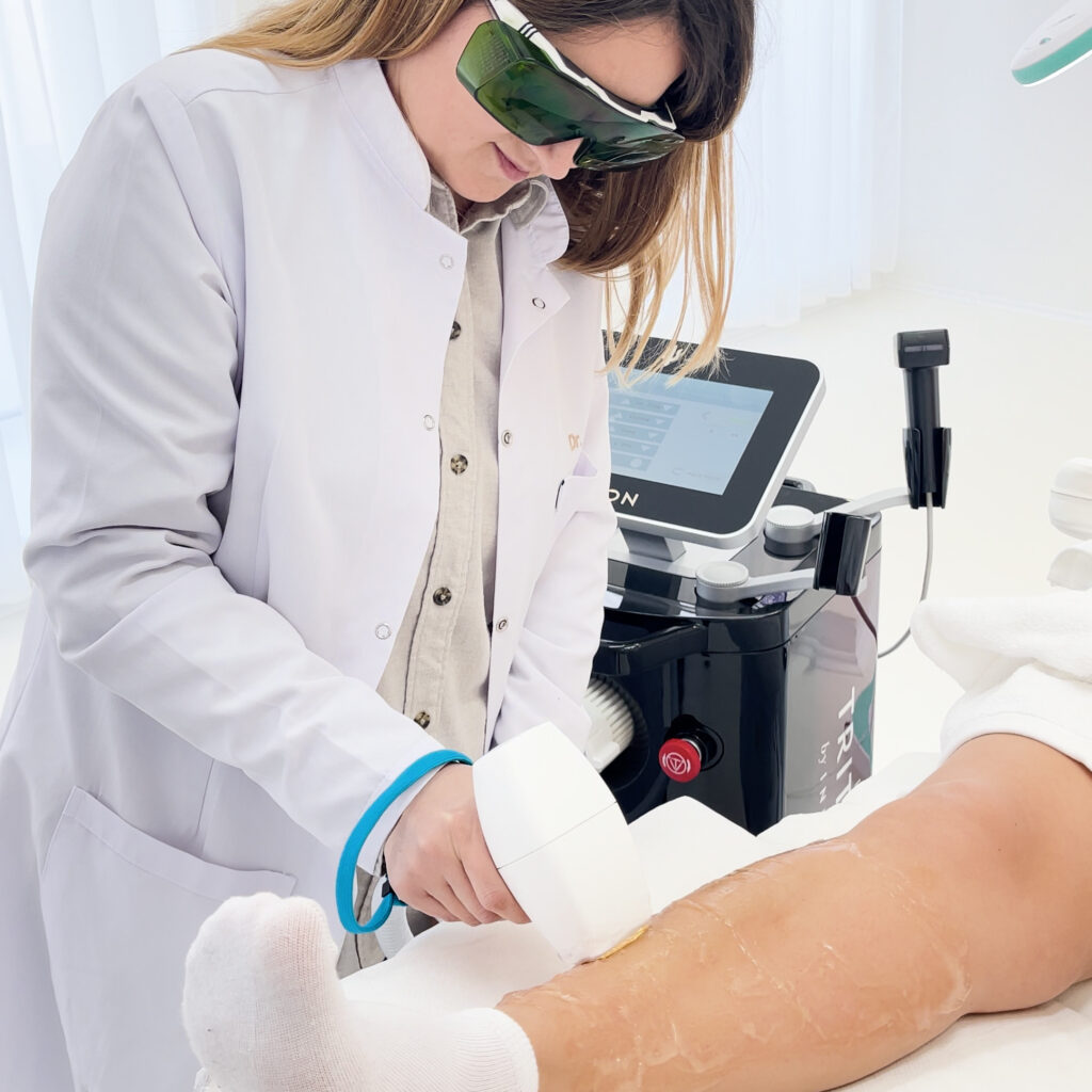 Video Laserbehandlung