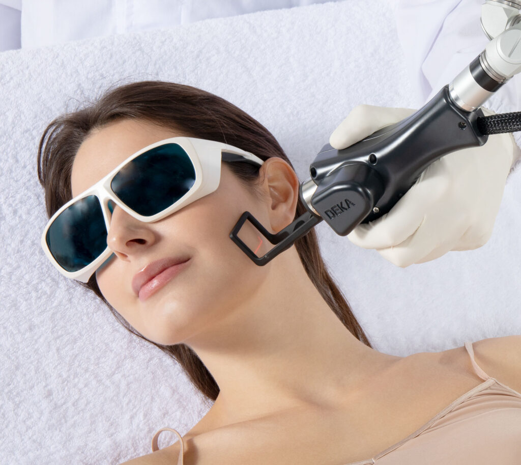 Tetra CO2 Laserbehandlung